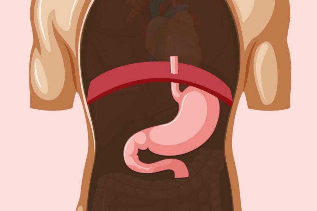 abdominal para quem tem hernia de hiato